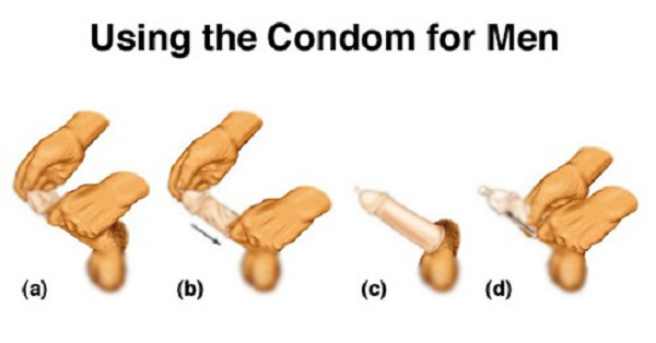 طرز استفاده از کاندوم